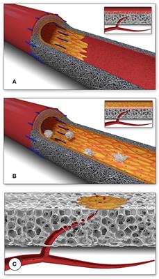 Progressive Reinvention or Destination Lost? Half a Century of Cardiovascular Tissue Engineering